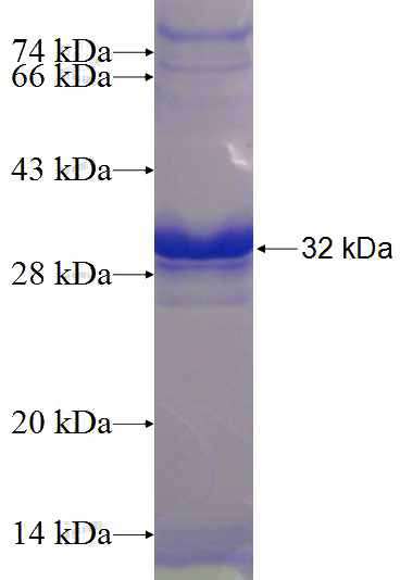 Recombinant Human LDOC1L SDS-PAGE