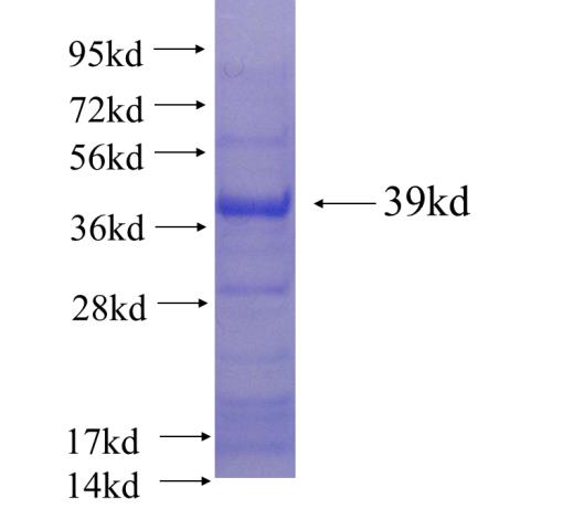 Recombinant human PYGO2 SDS-PAGE