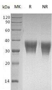 Human EFNB2/EPLG5/HTKL/LERK5 (His tag) recombinant protein