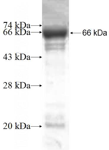 Recombinant Human NOMO2 SDS-PAGE