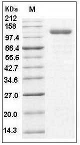 Human Endoglin / CD105 / ENG Protein (Fc Tag) SDS-PAGE