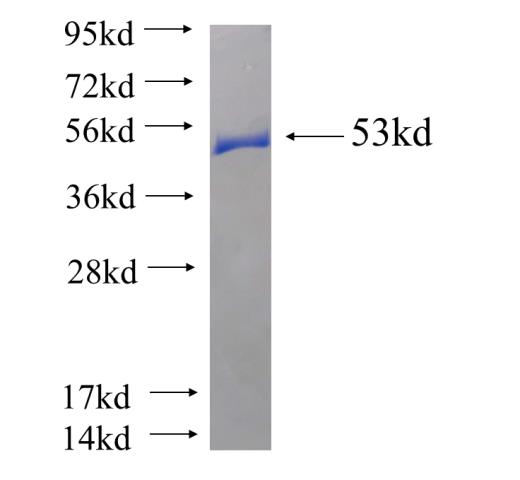 Recombinant human USP15 SDS-PAGE