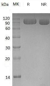 Human VASN/SLITL2/UNQ314/PRO357/PRO1282 (His tag) recombinant protein