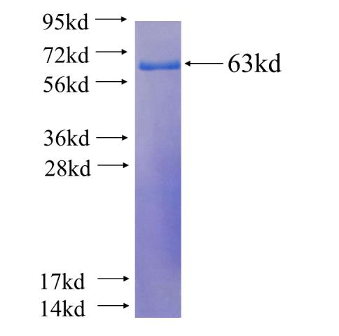 Recombinant human IGF2BP3 SDS-PAGE
