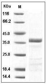 Human tPA / PLAT Protein SDS-PAGE