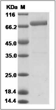 Human CD177 / PRV-1 / PRV1 Protein (Fc Tag) SDS-PAGE