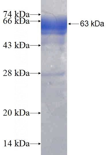 Recombinant Human ATXN10 SDS-PAGE