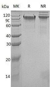 Human NLGN1/KIAA1070 (His tag) recombinant protein