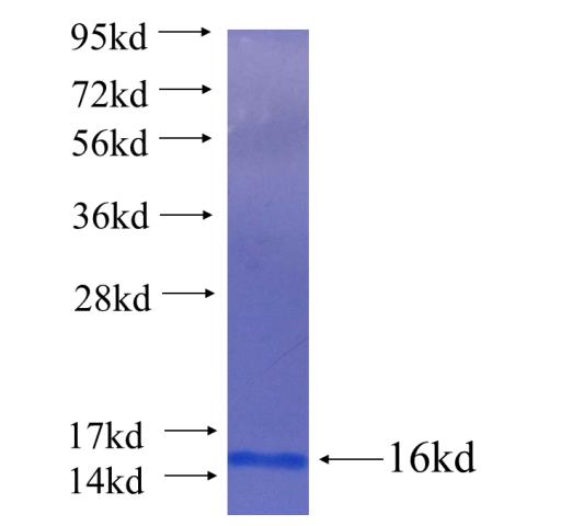 Recombinant human YTHDF1 SDS-PAGE