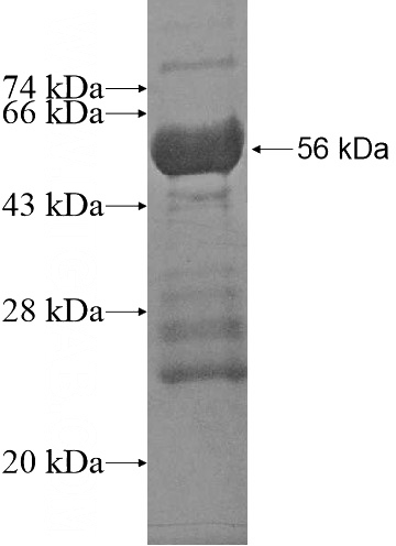 Recombinant Human C16orf57 SDS-PAGE