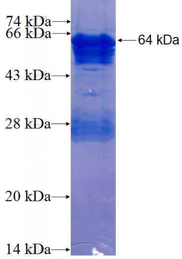 Recombinant Human JUP SDS-PAGE