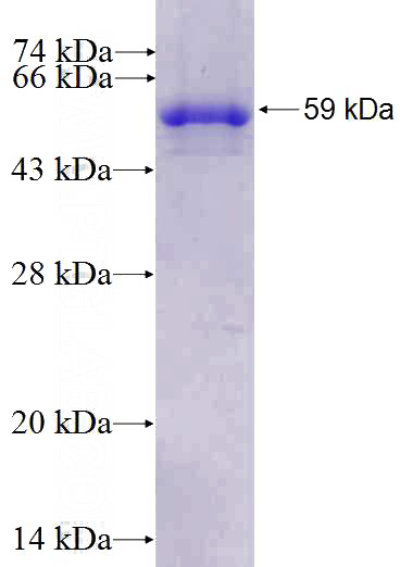 Recombinant Human Calponin SDS-PAGE