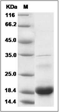 Human FUOM / Fucose mutarotase / FucM / C10orf125 Protein (His Tag) SDS-PAGE