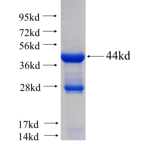 Recombinant human MYL12B SDS-PAGE