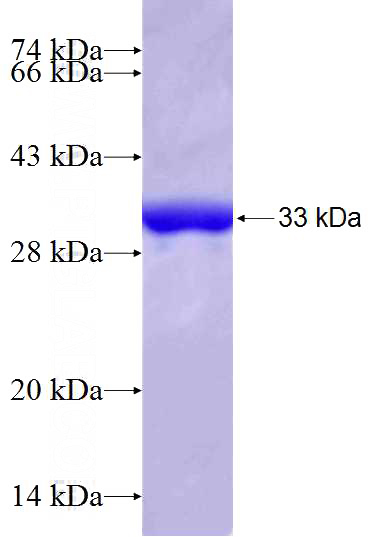 Recombinant Human MRPL45 SDS-PAGE