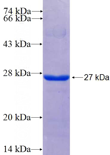 Recombinant Human SLC39A12 SDS-PAGE