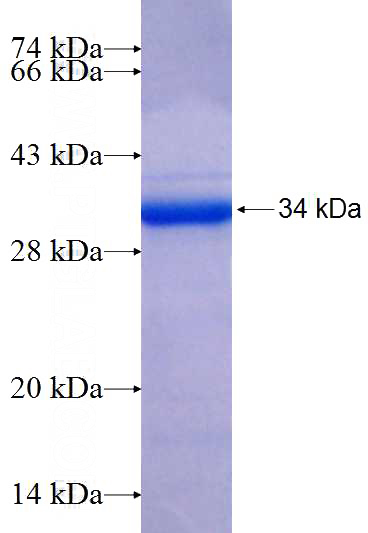Recombinant Human DNAJB14 SDS-PAGE
