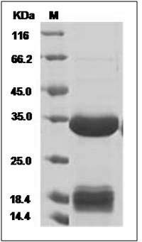Human Carbonic Anhydrase IV / CA4 Protein (His Tag) SDS-PAGE