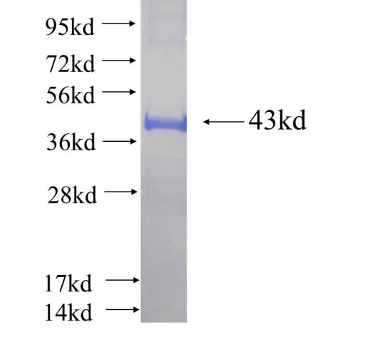 Recombinant human FGD3 SDS-PAGE
