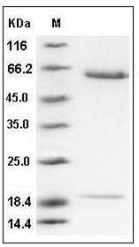 Mouse PCSK9 / NARC1 Protein (His Tag) SDS-PAGE