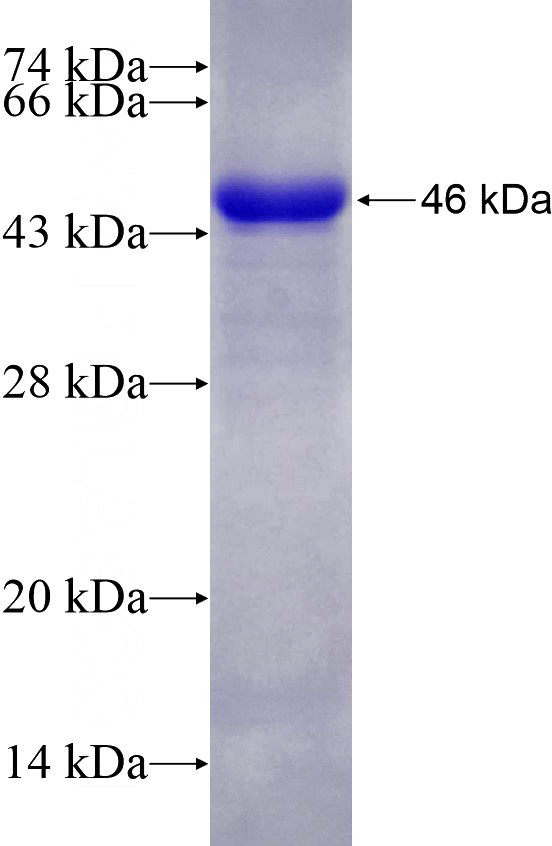 Recombinant Human CDK9 SDS-PAGE