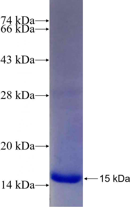 Recombinant Human KIF21B SDS-PAGE