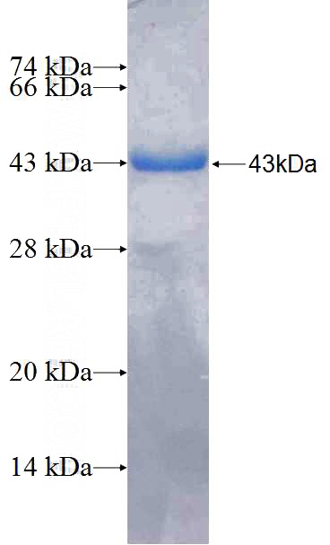 Recombinant Human HEATR3 SDS-PAGE