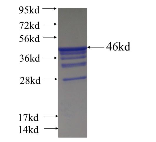 Recombinant human NDUFAF2 SDS-PAGE