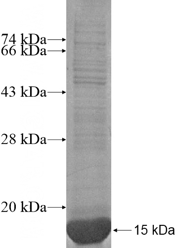 Recombinant Human MORN2 SDS-PAGE