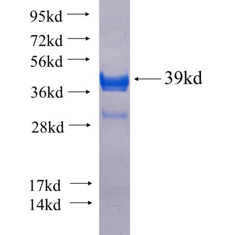 Recombinant human ITK SDS-PAGE