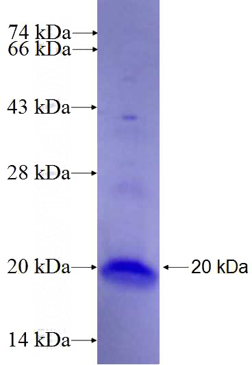 Recombinant Human THAP7 SDS-PAGE