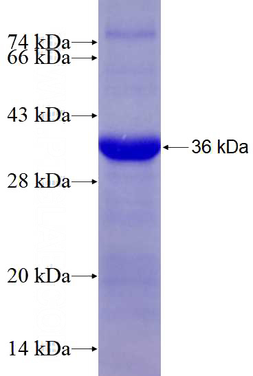 Recombinant Human SCRN2 SDS-PAGE