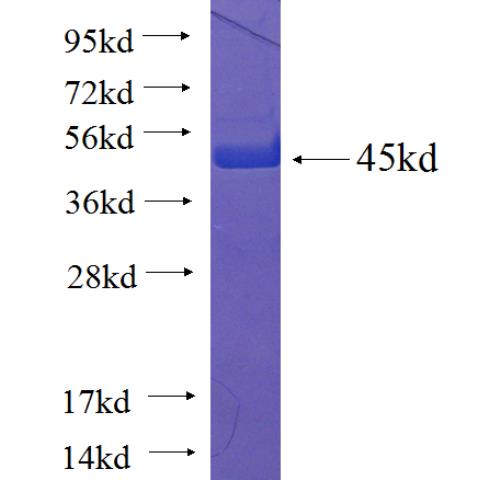 Recombinant human TRAPPC6A SDS-PAGE