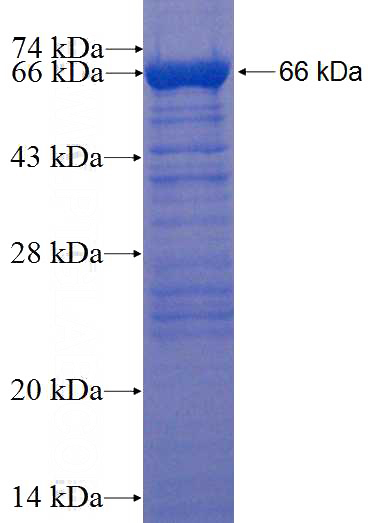 Recombinant Human PSMC1 SDS-PAGE