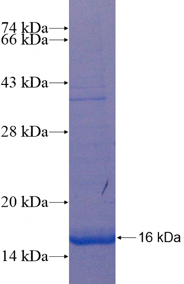 Recombinant Human CISD2 SDS-PAGE