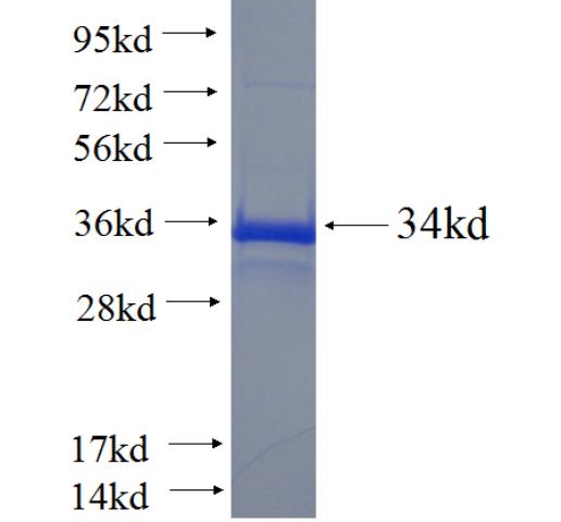 Recombinant human RIPPLY2 SDS-PAGE