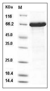 Human CXCL1 / MGSA / NAP-3 Protein (His & NusA Tag) SDS-PAGE