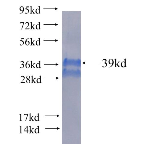Recombinant human SEPX1(Full length) SDS-PAGE