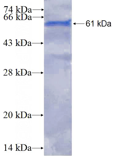 Recombinant Human SIAH2 SDS-PAGE