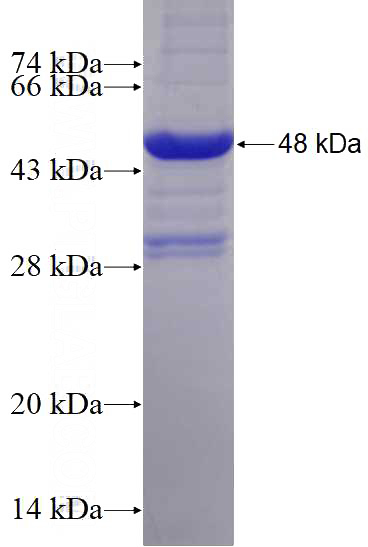 Recombinant Human NMDAR2A/GRIN2A SDS-PAGE