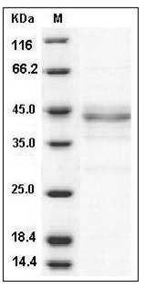 Human TRIB2 / TRB2 Protein SDS-PAGE