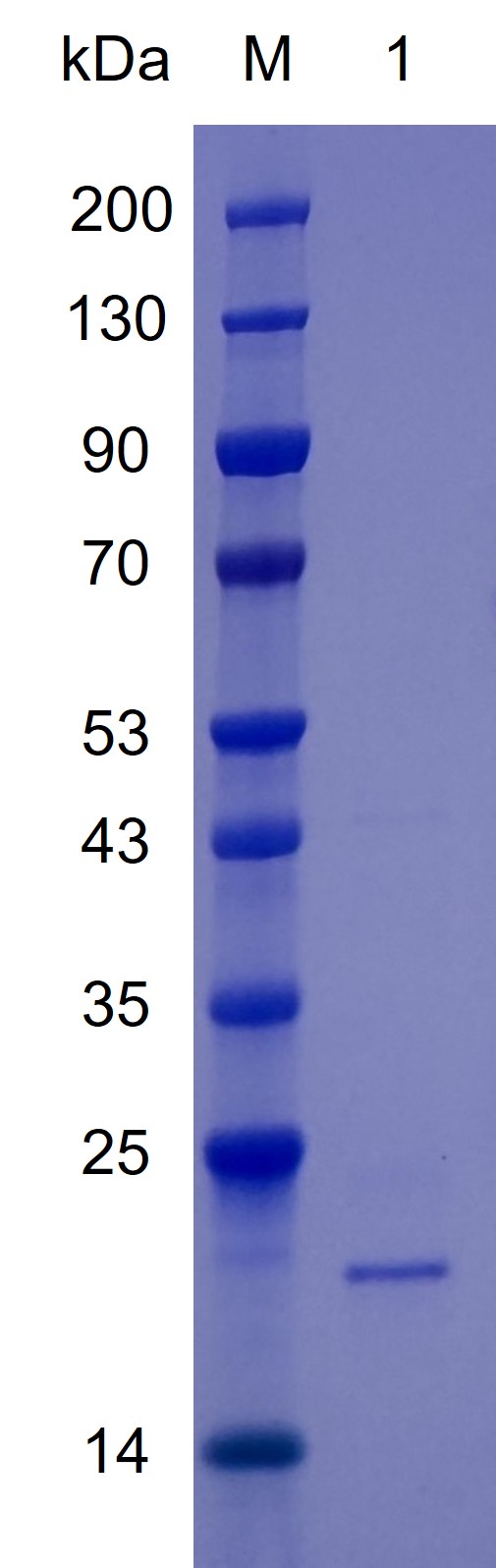 Recombinant TBP protein (His tag) SDS-PAGE