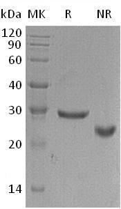 Human GLIPR1/GLIPR/RTVP1 (His tag) recombinant protein