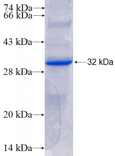 Recombinant Human PRSS33 SDS-PAGE