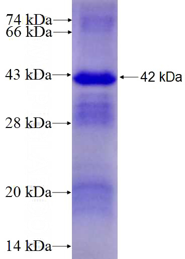 Recombinant Human CRTAP SDS-PAGE