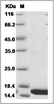 Human Profilin 2 / PFN2 Protein (His Tag) SDS-PAGE