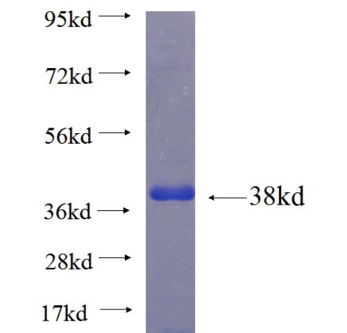Recombinant human HMOX2 SDS-PAGE