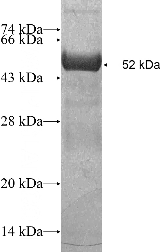 Recombinant Human Kindlin 1 SDS-PAGE