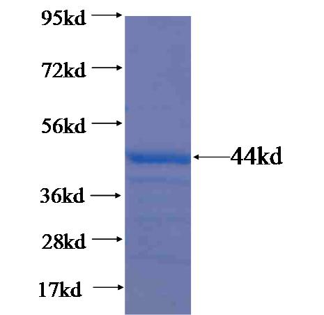 Recombinant human HEATR4 SDS-PAGE