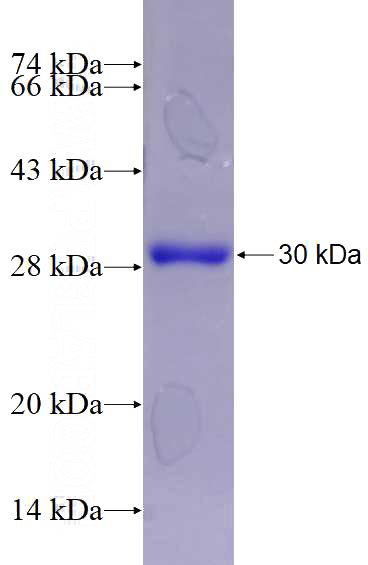 Recombinant Human RALA SDS-PAGE